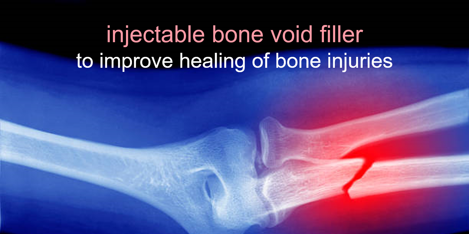 Injectable bone void filler to improve healing of bone injuries.