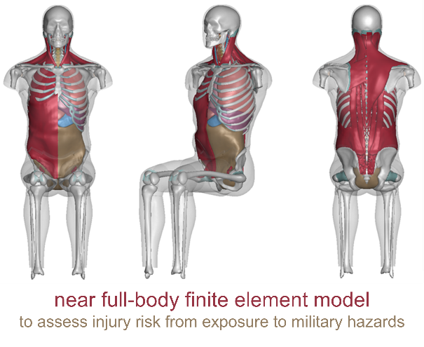 Near Full-body finite element model to assess injury risk from exposure to military hazards