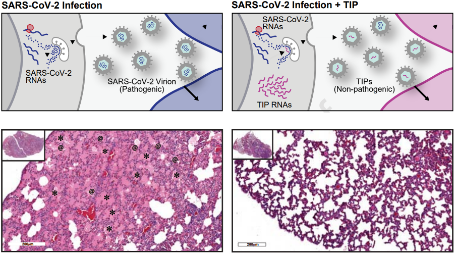 SARS-CoV-2 Infection Process Diagram